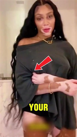 This Condition Can Change Your Skin Forever 😱#shorts