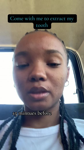 #tooth#toothextraction#pain#viralvideos#fyp#blowthisup#blowthisup#adore_nash#viral_video