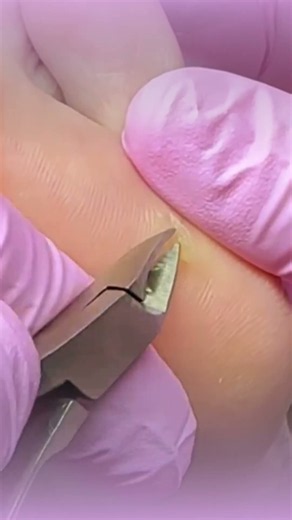 ¿Te gustaría aprender pedicura estética, spa de pies y técnicas de onicriptosis? 👣✨