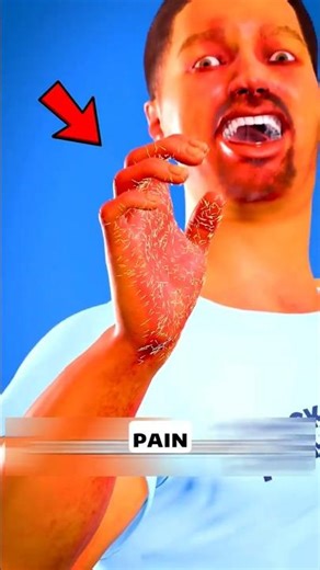The MOST Painful TREE You Should Never Touch