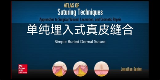 深部组织的缝合技术：筋膜与真皮——4.1单纯埋入式真皮缝合