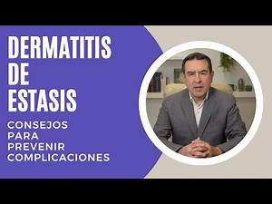 Stasis dermatitis | Tips to avoid complications
