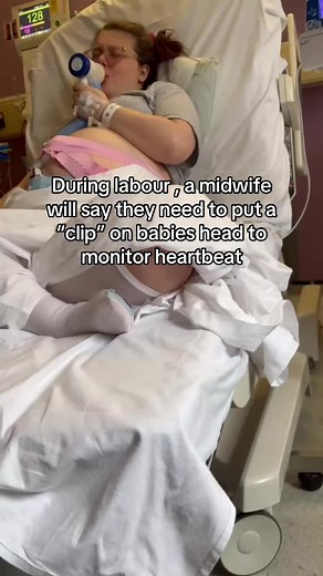 Understanding Fetal Scalp Monitoring During Labor