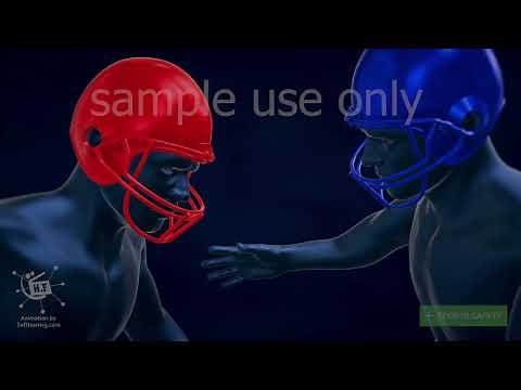 Concussion 3d medical animation | Traumatic Brain Injury | dandelion team