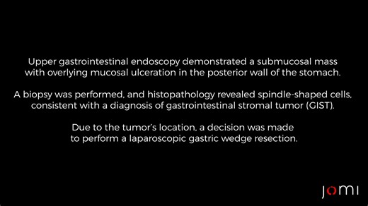 Gastrectomia GIST Lap