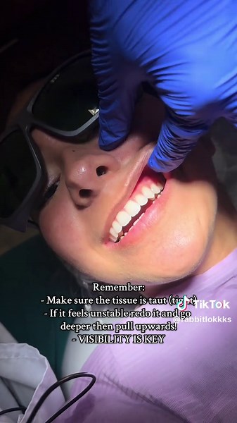 Tutorial for ASA Injection in Dental Anesthesia