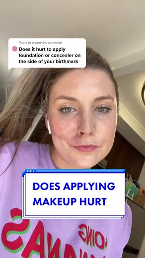 How to Conceal Birthmarks with Makeup