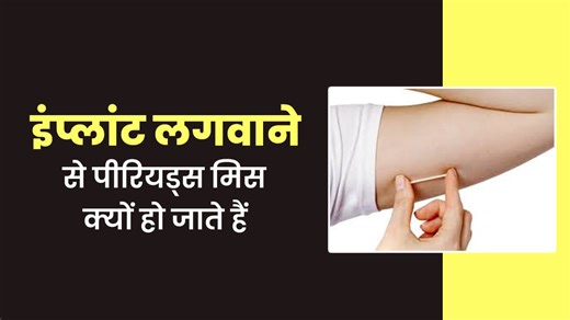 बर्थ कंट्रोल इम्प्लांट लगवाने से पीरियड्स मिस क्यों हो जाते हैं, बता रहे हैं डॉक्टर
