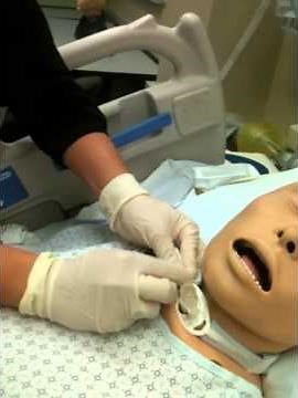 Tracheostomy Cannula Change and Trach Ties N3170