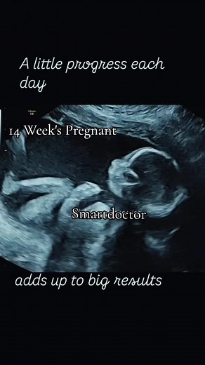 14 Weeks Pregnant: A Peek Inside the Womb