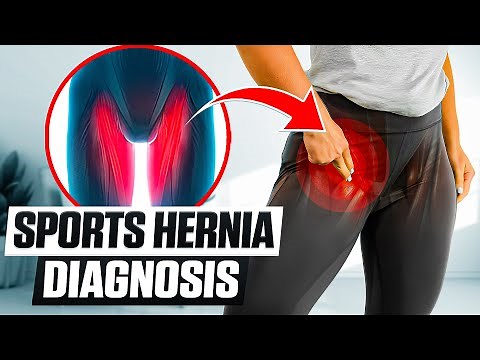 Top Sports Hernia Self-Diagnosis Tips 2024