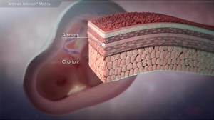 Arthrex Amnion™ Matrix