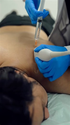 Ben Klyachman, DO ✡︎ | Trigger points are hyperirritable knots in skeletal muscle, often caused by overuse, stress, or injury, leading to pain and restricted... | Instagram