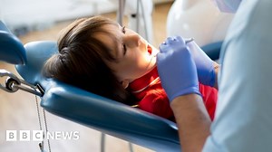 More children having teeth out in hospital in England