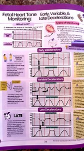25K views · 104 reactions | Fetal heart tone monitoring quick review...