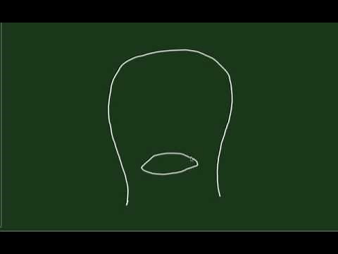 B-Lynch for Management of Postpartum Hemorrhage