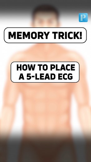 ECG Placement Made Easy: Remember the 5-Lead Setup! #ECG #tricks #memorytricks #medical #medicos #prepladder | PrepLadder Medical