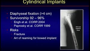 Femoral Reconstruction and Management of Femoral Bone Loss in Revision