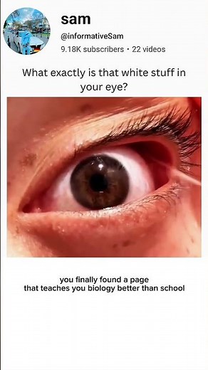 What is the white stuff in your eyes 👀 #brainlearning #biologyscience #medicaleducation