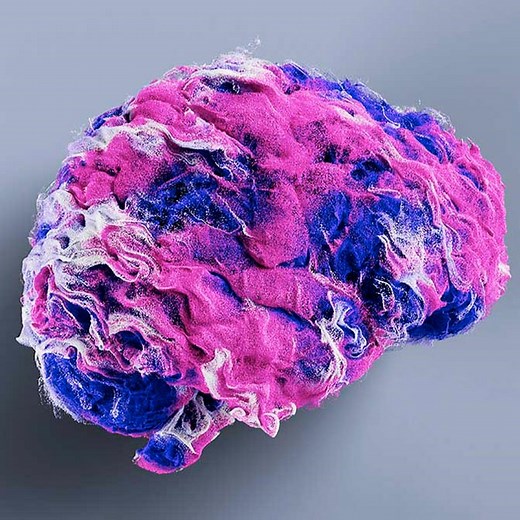 MR image reconstruction with AIR Recon DL