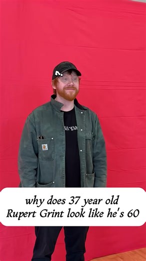 Rupert Grint's Shocking Transformation at 37