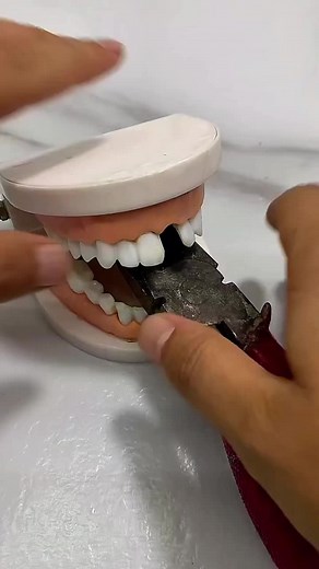Dental Model Manipulation Demonstration