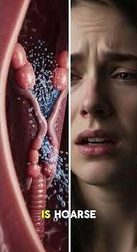 What Happens Inside Your Throat When Laryngitis Strikes