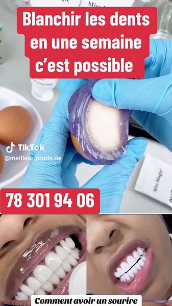 #purpletoothpaste #pourtoi #glorysmile #TikTokAwardsVN #blanchimentdentaire