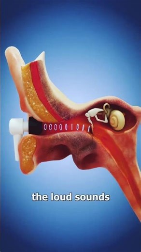 कानों में घंटी बजती हे जानिए कैसे /Earphone Lagane se Kya Hota Hai? | Hearing Loss & Tinnitus सच