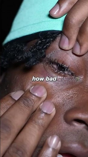 Prayers For Kanel Joseph.. 😢🙏