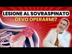 Supraspinatus Injury | How to Recognize It and When to Operate