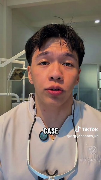 Kenapa Tambal Gigi Bisa Sampai 1 Jam? Penjelasan Proses Tambal Gigi