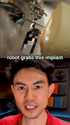 How the Robot SEES Your Brain 👁️