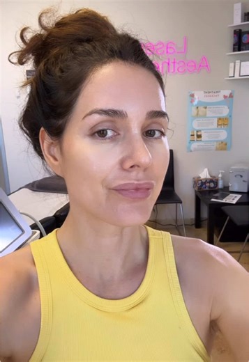 Sublative Skin Resurfacing: The Ultimate Laser Treatment