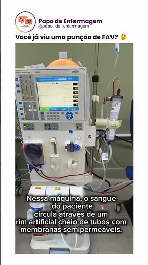 Você já viu uma punção de FAV? 🤔