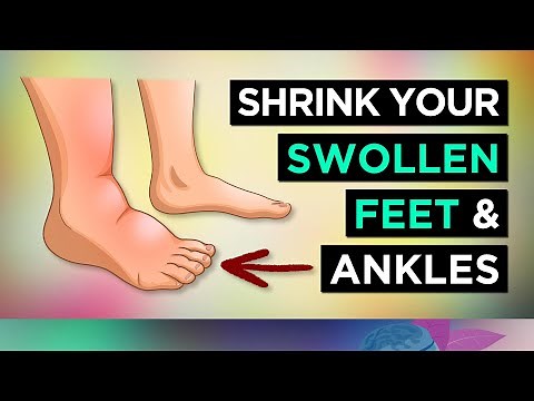 6 Ways To SHRINK Your SWOLLEN FEET & ANKLES (Remedies)