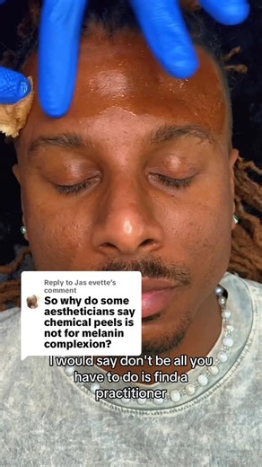 Jerron “Ronnie” Mitchell on Instagram: "P.O.C. Don’t Be Afraid. Find a practitioner that understands the signs symptoms and triggers of a chemical peel application and process. #ChemicalPeel #LosAngeles #Skincare #Atlanta"