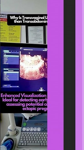 Transvaginal Ultrasound Scan In Pregnancy