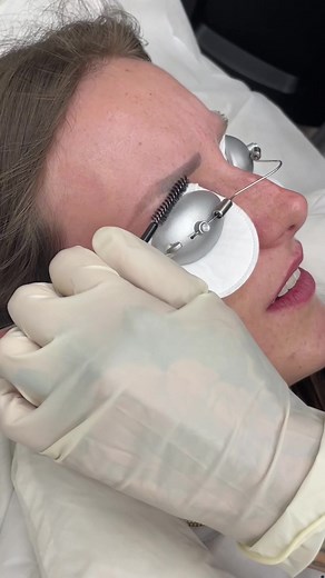 Effective Eyebrow Tattoo Removal: Transforming Brows Instantly