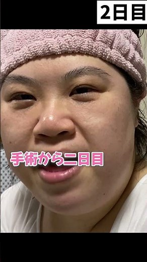 最終章粉瘤その２ 毎日に日課の薬をぬり、傷口パッドを取り替えます。段々良くなってるのがこの動画でよくわかります。 #shots＃粉瘤＃手術