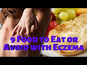 9 Food to Eat or Avoid with Eczema | Healthy eating