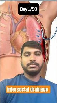 Chest Tube Drainage TRICK 🚨 | Tidaling vs Bubbling | NORCET Nursing MCQ! #nursingexams