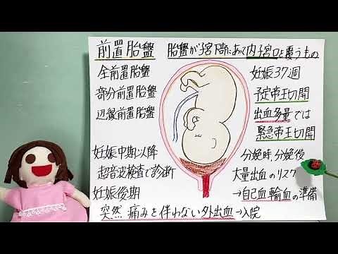 母性看護学 前置胎盤 令和5年版看護師国家試験出題基準