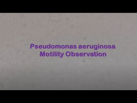 Pseudomonas aeruginosa Motility Observation