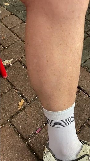 Calf Muscle Twitching and Rippling - Boss post ride
