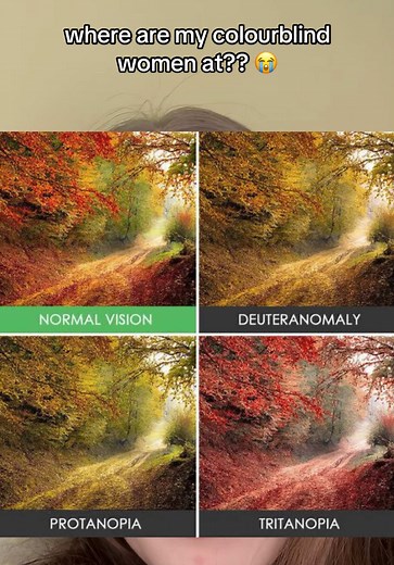 Understanding Color Blindness in Women