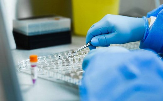 【科研前沿211期】CRISPR基因敲除实验protocol