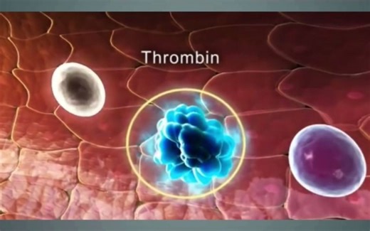 3D医学动画：血液凝固的发生机制