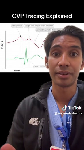 Central Venous Pressure (CVP) Waveform Explained #anesthesia #anesthesiology #medicine #surgery #cardiology #cardiacsurgery #cardiacanesthesia #intensivecareunit #icu #fellow #crna #nurses #icunurse #physiology #medstudent #medschool #cardiacphysiology #cvp #onlinemeded #meded #foamed #greenscreen