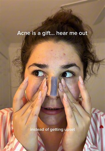 Korean Skincare for Acne: Purposeful Care for Acne-Prone Skin